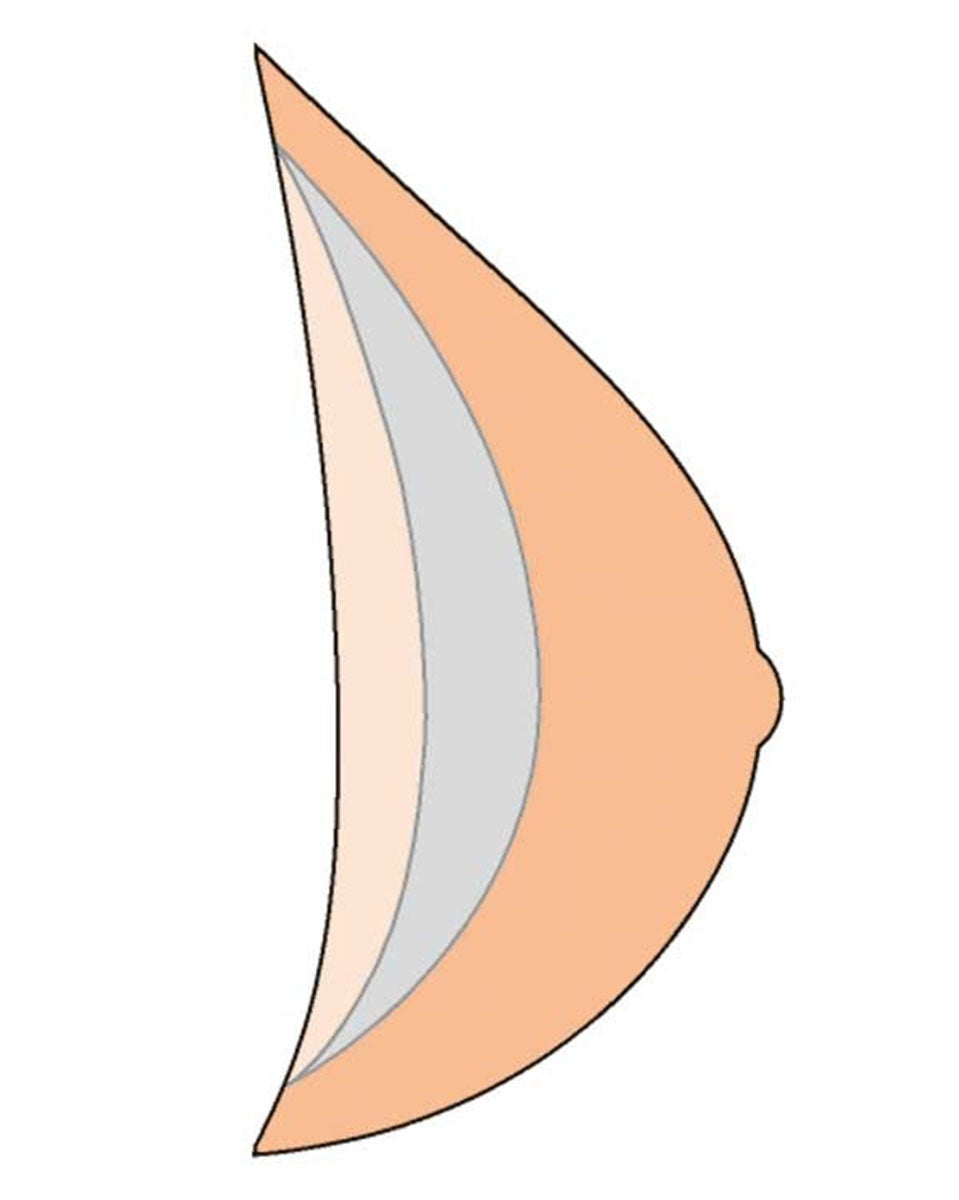 Amoena Natura Light 1SN 402 Breast Form - Ivory